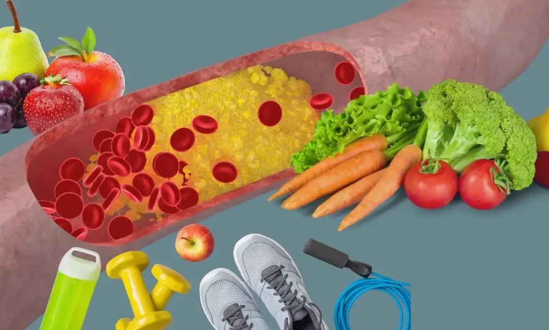 COLESTEROL ALTO: ALIMENTACIÓN Y ESTILO DE VIDA